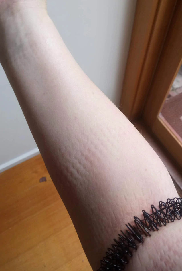 Kaiko_Wrist_Spikey_black_indents_in_arm