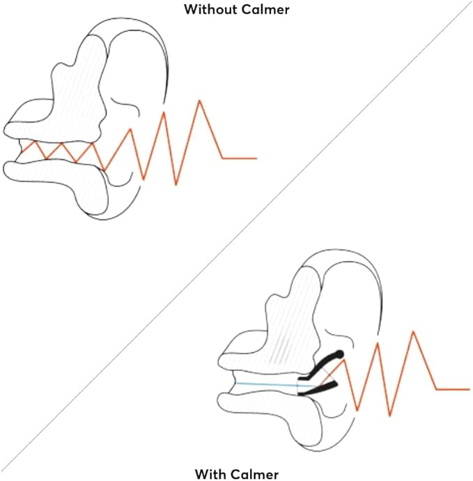 FLARE CALMER- Soft Mini's