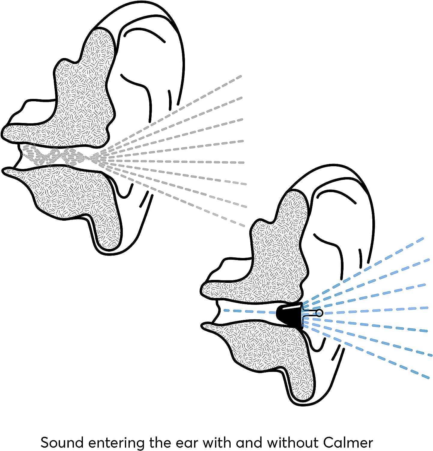 Flare_Calmer_ear_picture