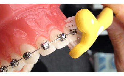 Surround_Toothbrush_brushing_over_around_braces